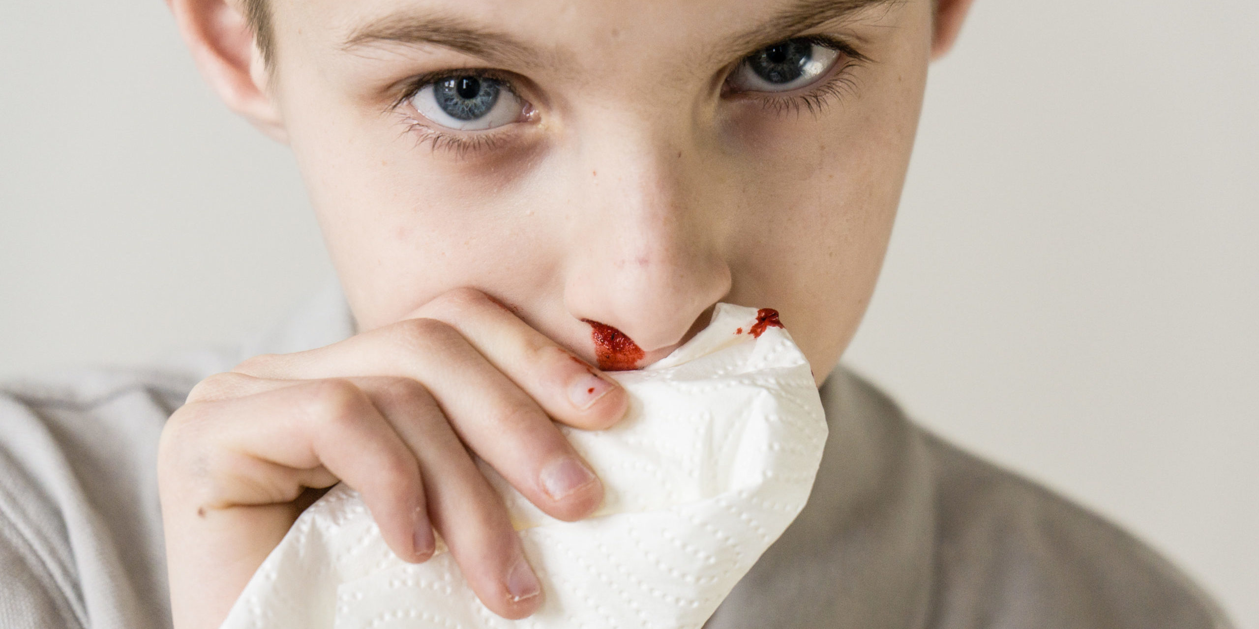 السلائل الأنفية الأسباب وأهم الأعراض وأحدث طرق العلاج