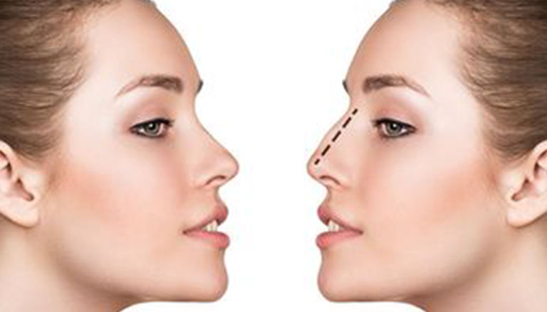 افضل دكتور تجميل انف في الاردن - الدكتور أنس ابوشملة